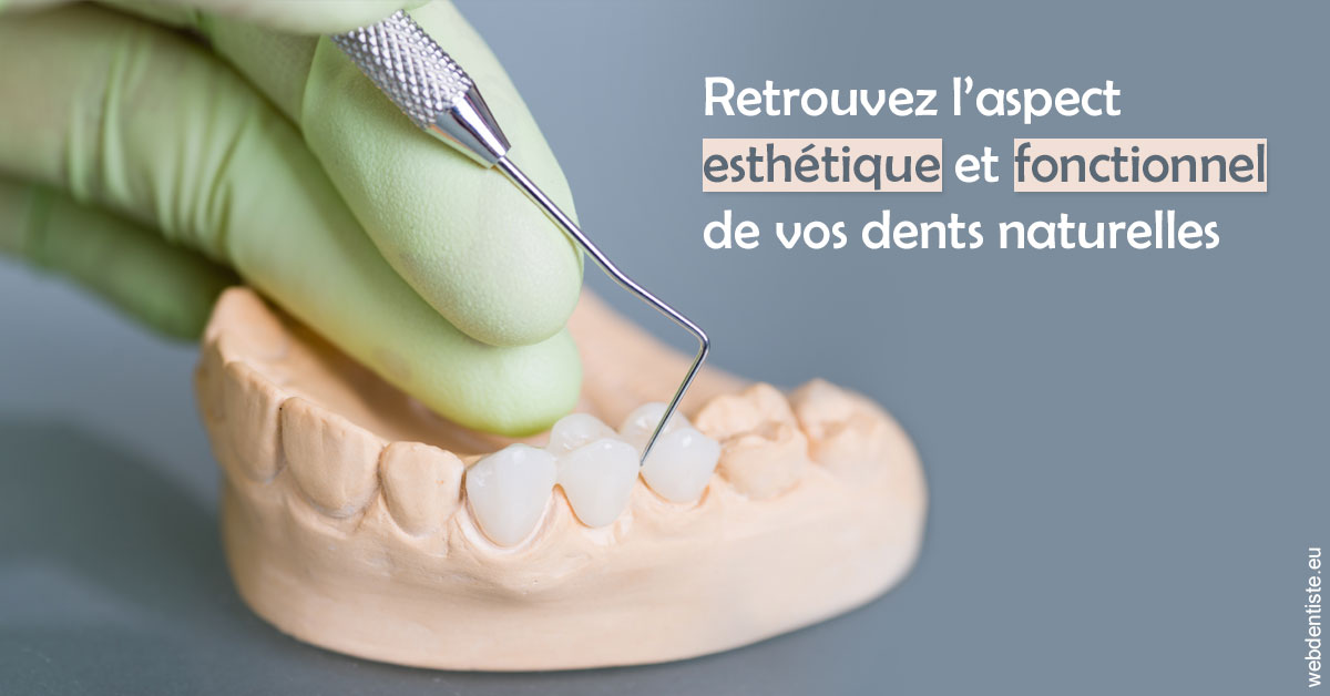 https://dr-henry-jeanluc.chirurgiens-dentistes.fr/Restaurations dentaires 1