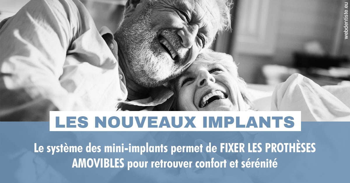 https://dr-henry-jeanluc.chirurgiens-dentistes.fr/Les nouveaux implants 2