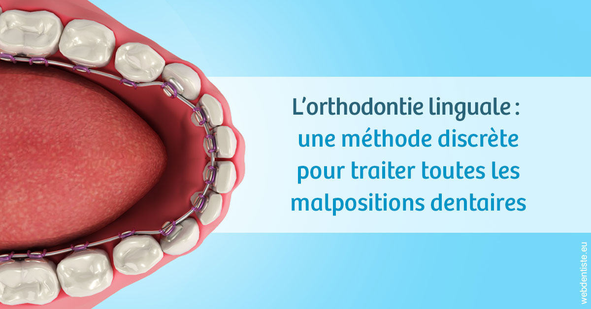 https://dr-henry-jeanluc.chirurgiens-dentistes.fr/L'orthodontie linguale 1