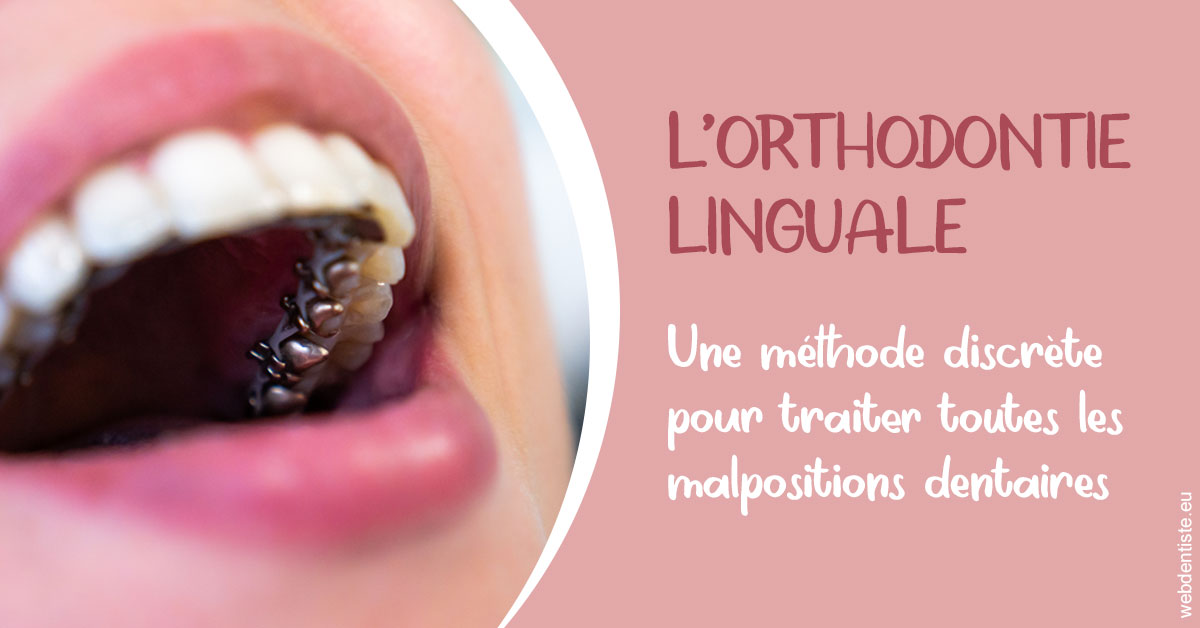 https://dr-henry-jeanluc.chirurgiens-dentistes.fr/L'orthodontie linguale 2