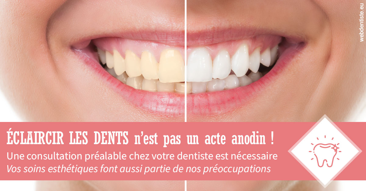 https://dr-henry-jeanluc.chirurgiens-dentistes.fr/Eclaircir les dents 1