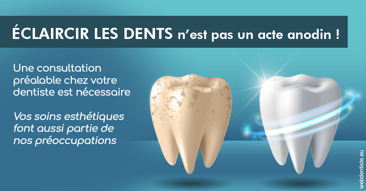 https://dr-henry-jeanluc.chirurgiens-dentistes.fr/Eclaircir les dents 2