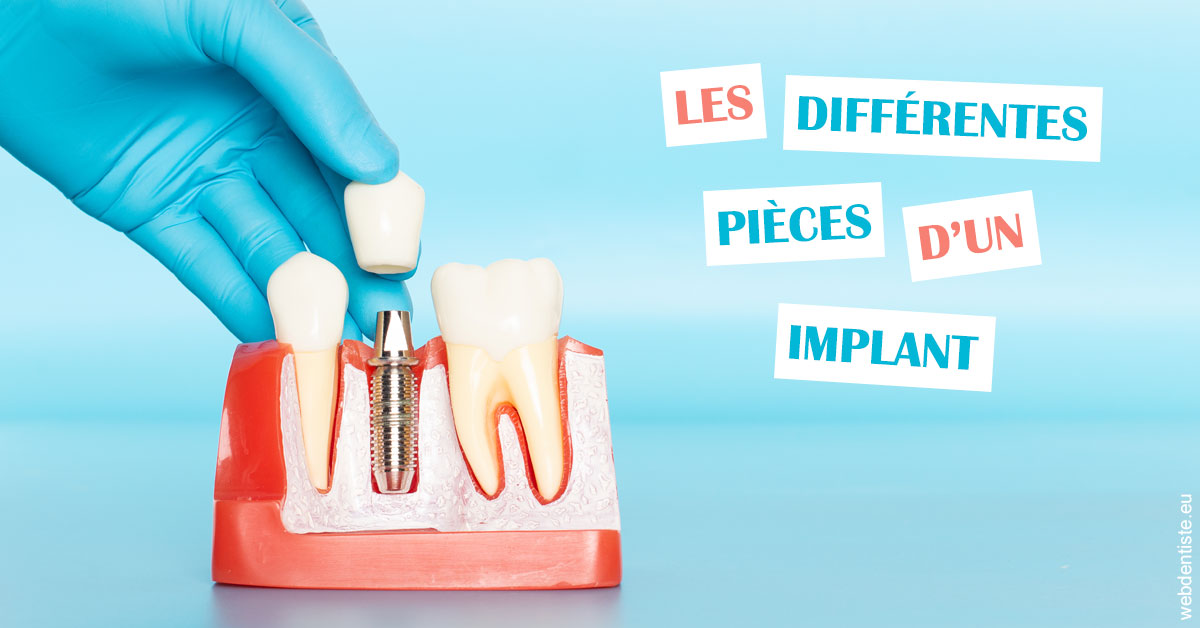 https://dr-henry-jeanluc.chirurgiens-dentistes.fr/Les différentes pièces d’un implant 2