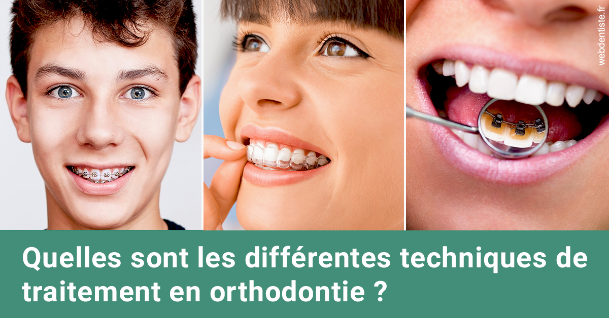https://dr-henry-jeanluc.chirurgiens-dentistes.fr/Les différentes techniques de traitement 2