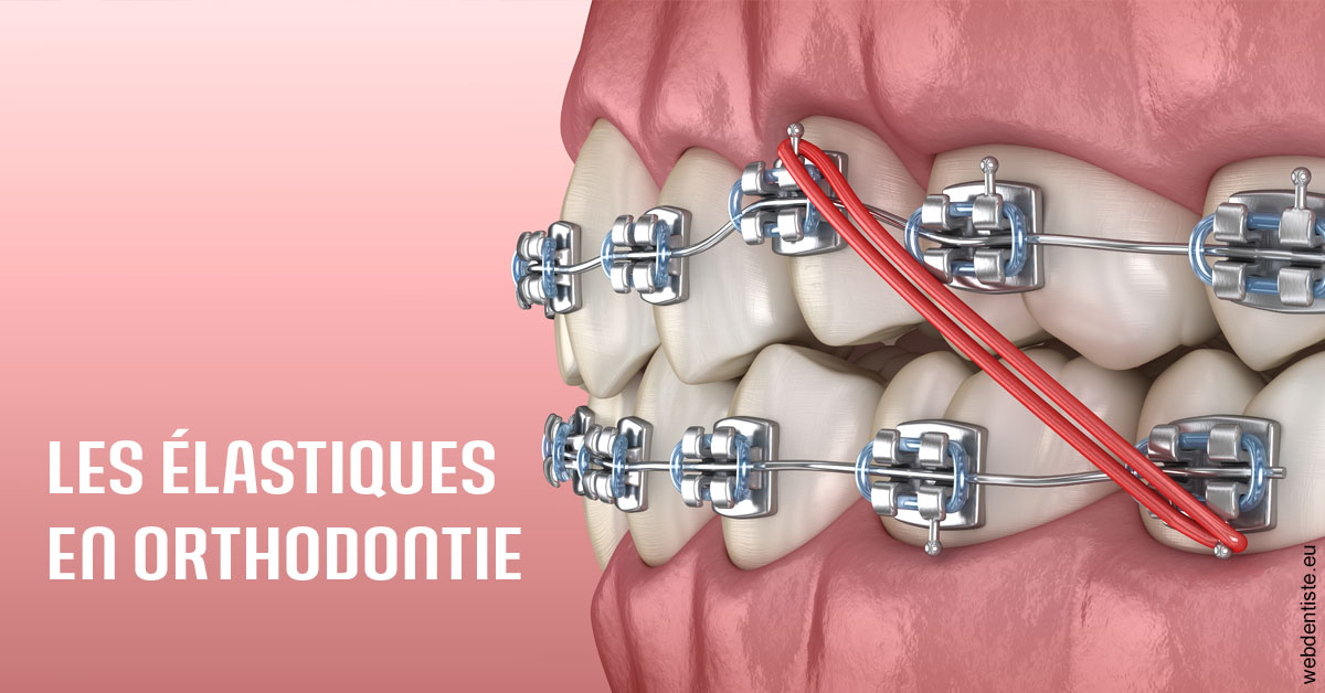 https://dr-henry-jeanluc.chirurgiens-dentistes.fr/Elastiques orthodontie 2