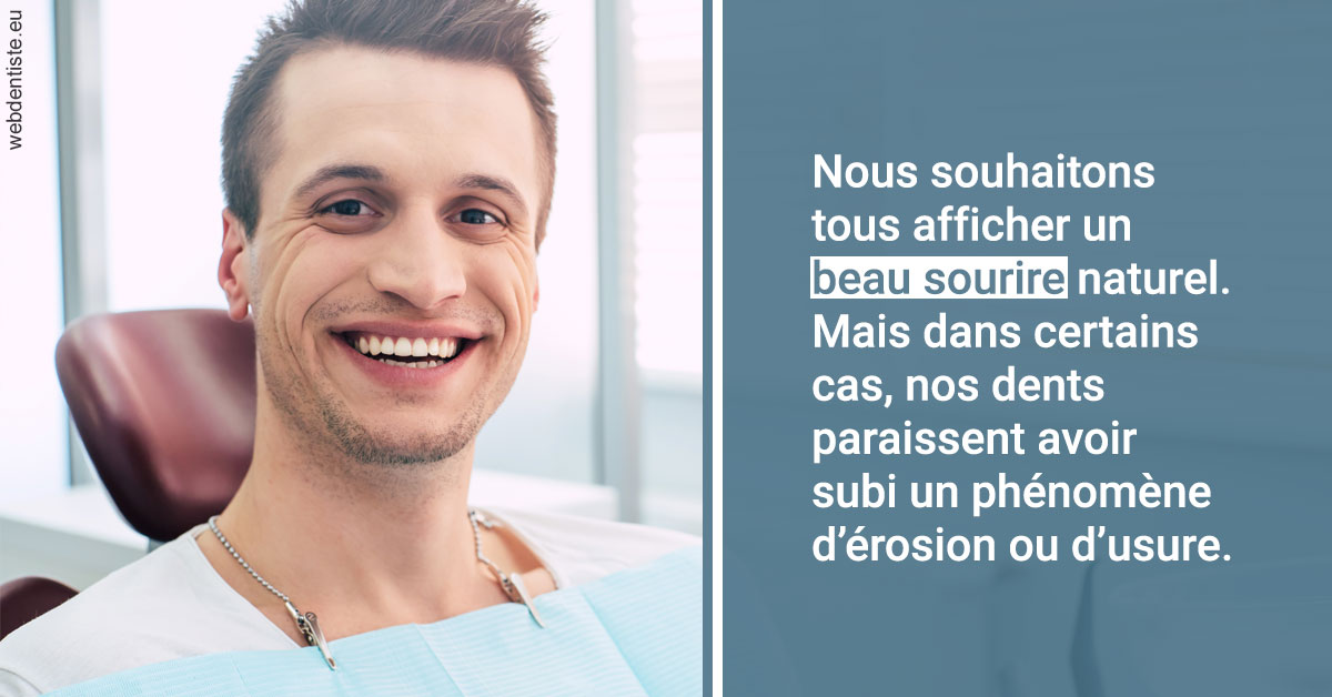 https://dr-henry-jeanluc.chirurgiens-dentistes.fr/Érosion et usure dentaire