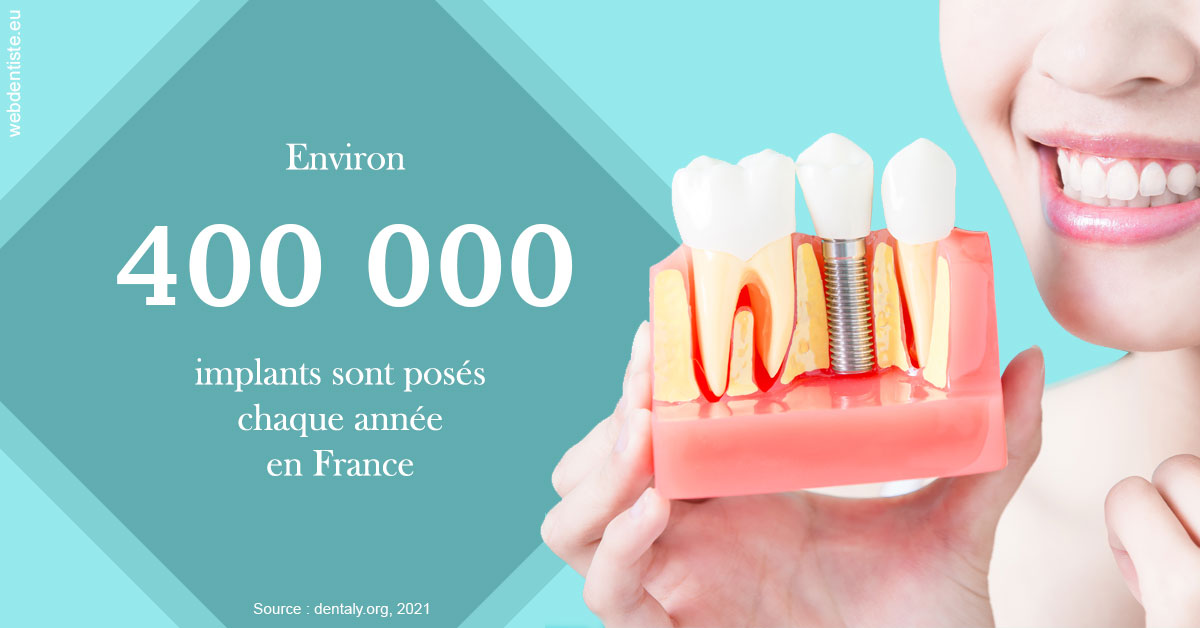 https://dr-henry-jeanluc.chirurgiens-dentistes.fr/Pose d'implants en France 2